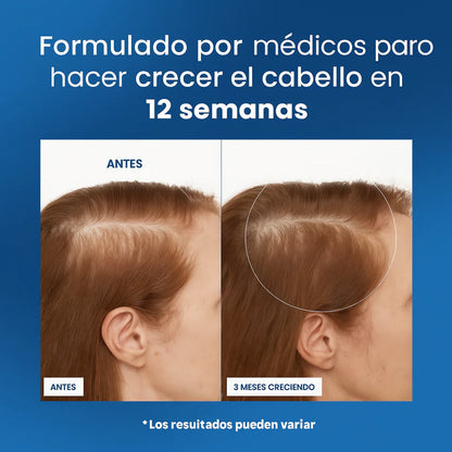 Rolon Bodywise estimula el crecimiento de tu cabello con el efecto del romero