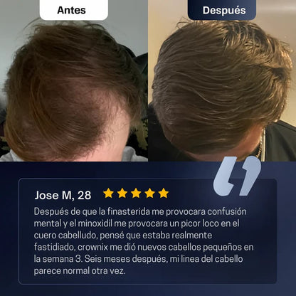 Rolon Bodywise estimula el crecimiento de tu cabello con el efecto del romero