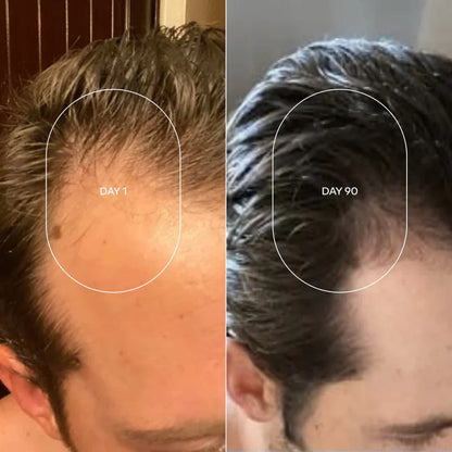 Rolon Bodywise estimula el crecimiento de tu cabello con el efecto del romero